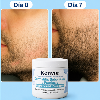 Crema Reparadora Para Barba